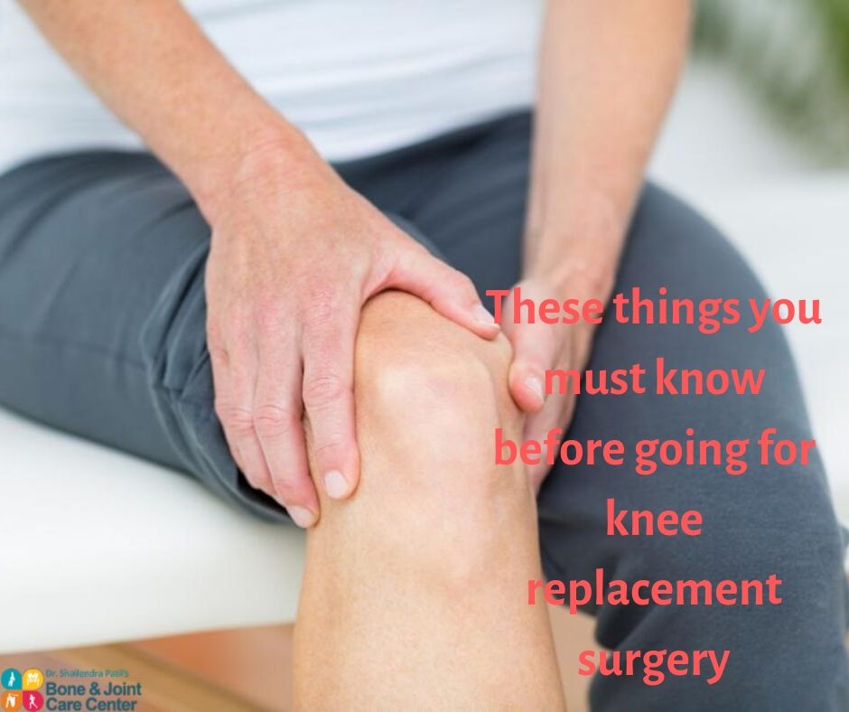 These things you must know before going for knee replacement surgery