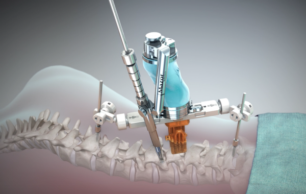 Robotic Spine Surgery For Maximum Improvement And Accuracy