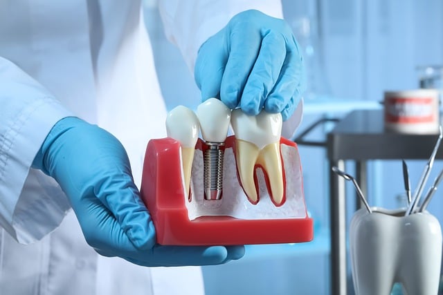 Are $399 Dental Implants Possible? Know The Real Cost