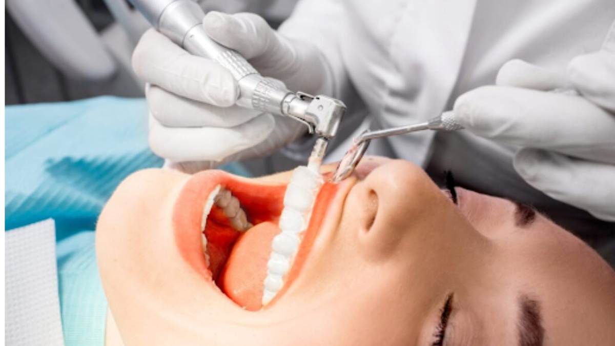 How Much Does a Dental Cleaning Cost? Complete Price Guide